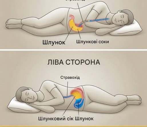 Яким ризикам ви наражаєте себе, спите на правому боці?